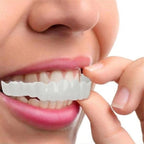 Reva | Facetas Dentárias Clip-On | Superior e Inferior Incluídas | Sorris