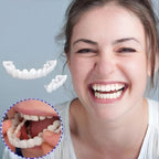 Reva | Facetas Dentárias Clip-On | Superior e Inferior Incluídas | Sorris