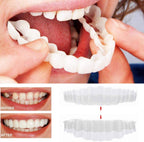 Reva | Facetas Dentárias Clip-On | Superior e Inferior Incluídas | Sorris