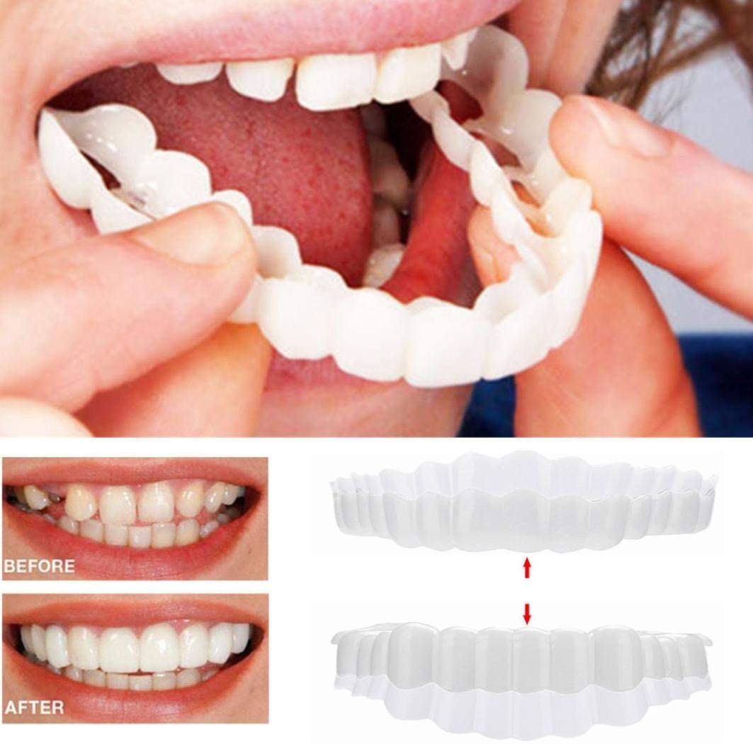 Reva | Facetas Dentárias Clip-On | Superior e Inferior Incluídas | Sorris