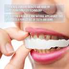 Reva | Facetas Dentárias Clip-On | Superior e Inferior Incluídas | Sorris