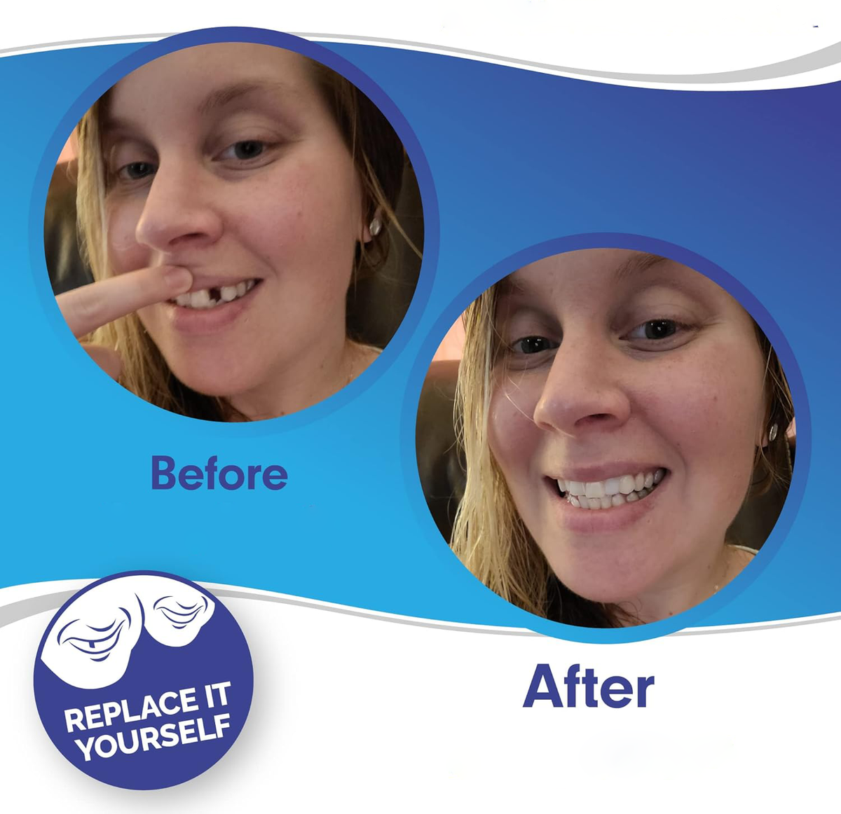Reva | Facetas Dentárias Clip-On | Superior e Inferior Incluídas | Sorris