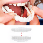 Reva | Facetas Dentárias Clip-On | Superior e Inferior Incluídas | Sorris