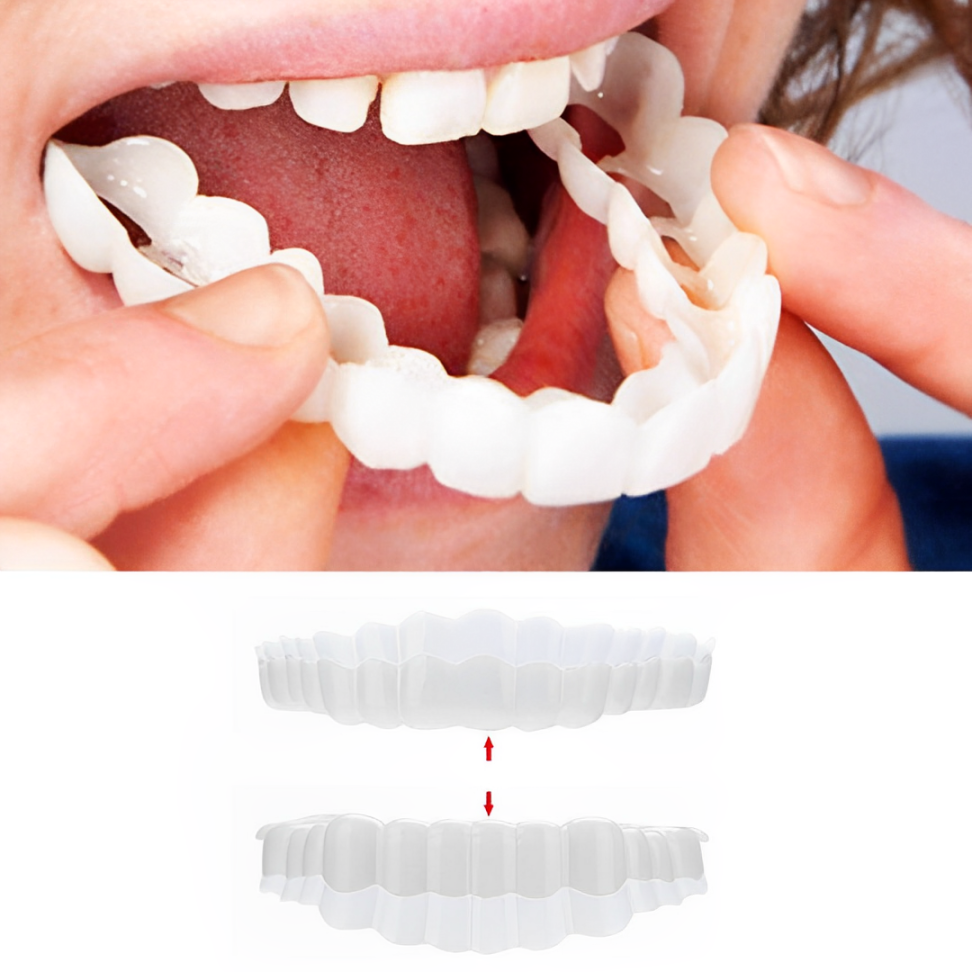 Reva | Facetas Dentárias Clip-On | Superior e Inferior Incluídas | Sorris